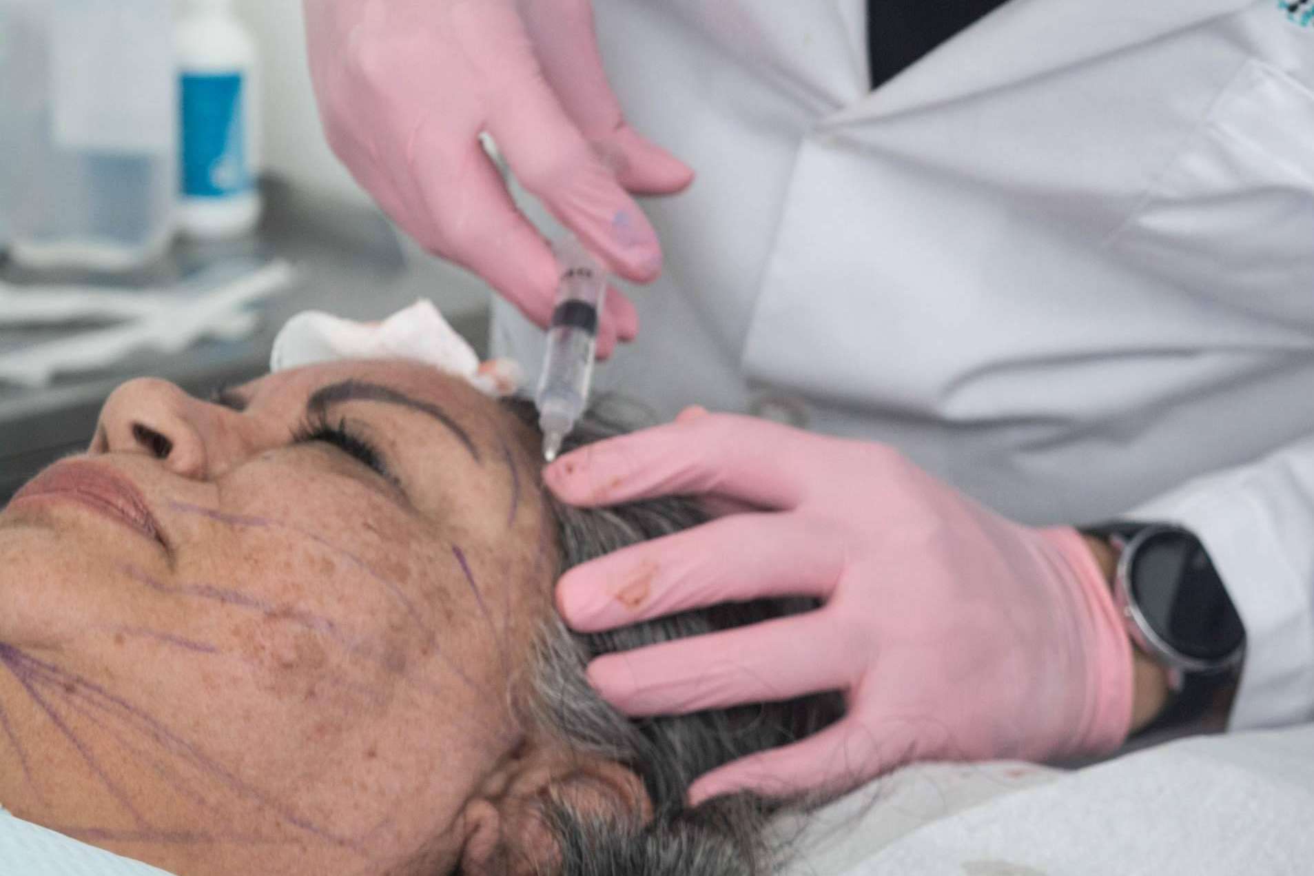 Las ventajas de los tratamientos antienvejecimiento y de belleza de Immunotherapy Regenerative Medicine