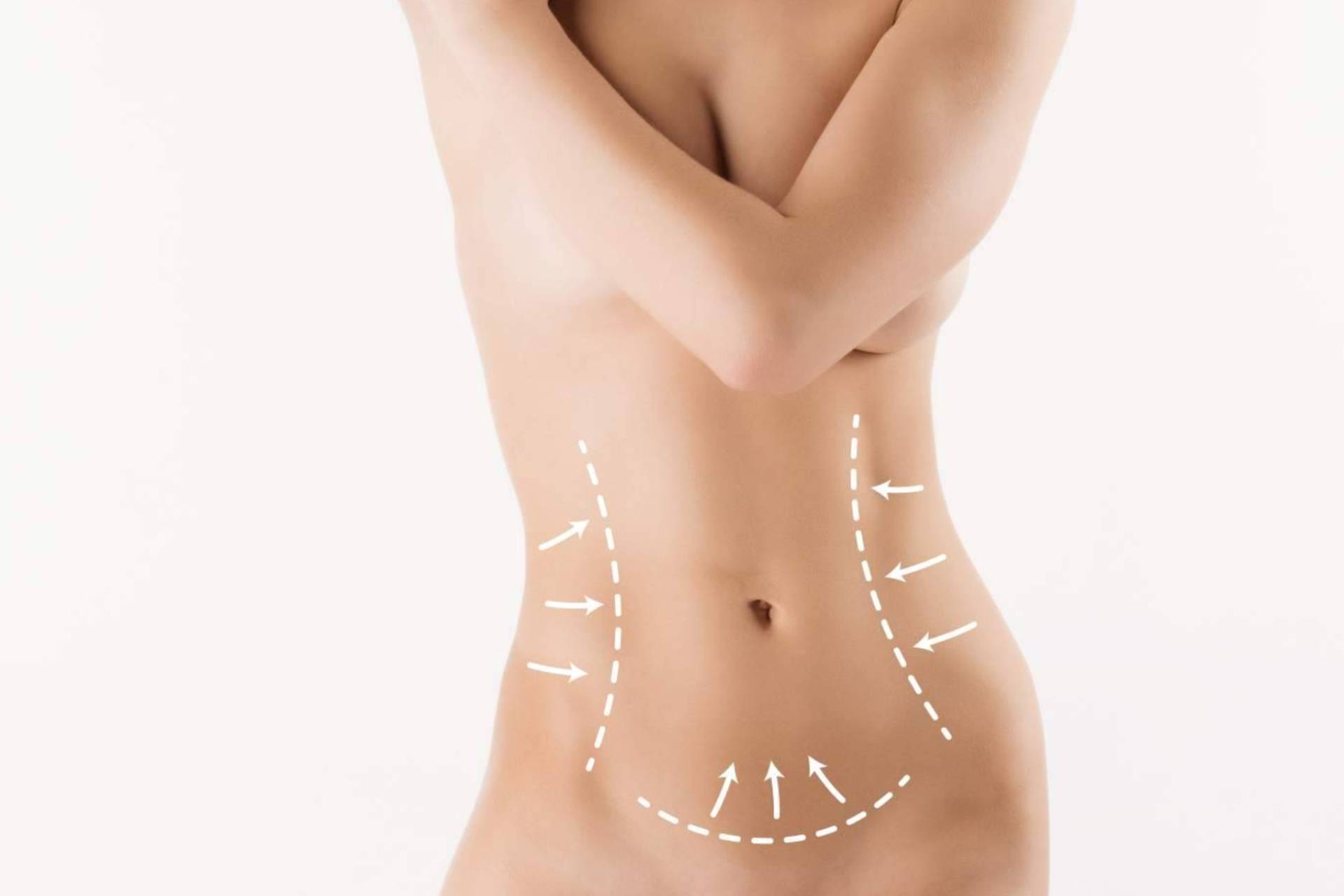 Lipoescultura con Ultrasonido y Vibrolipoescultura; Tecnologías que Favorecen Según el Dr. Cesar Martínez Correa